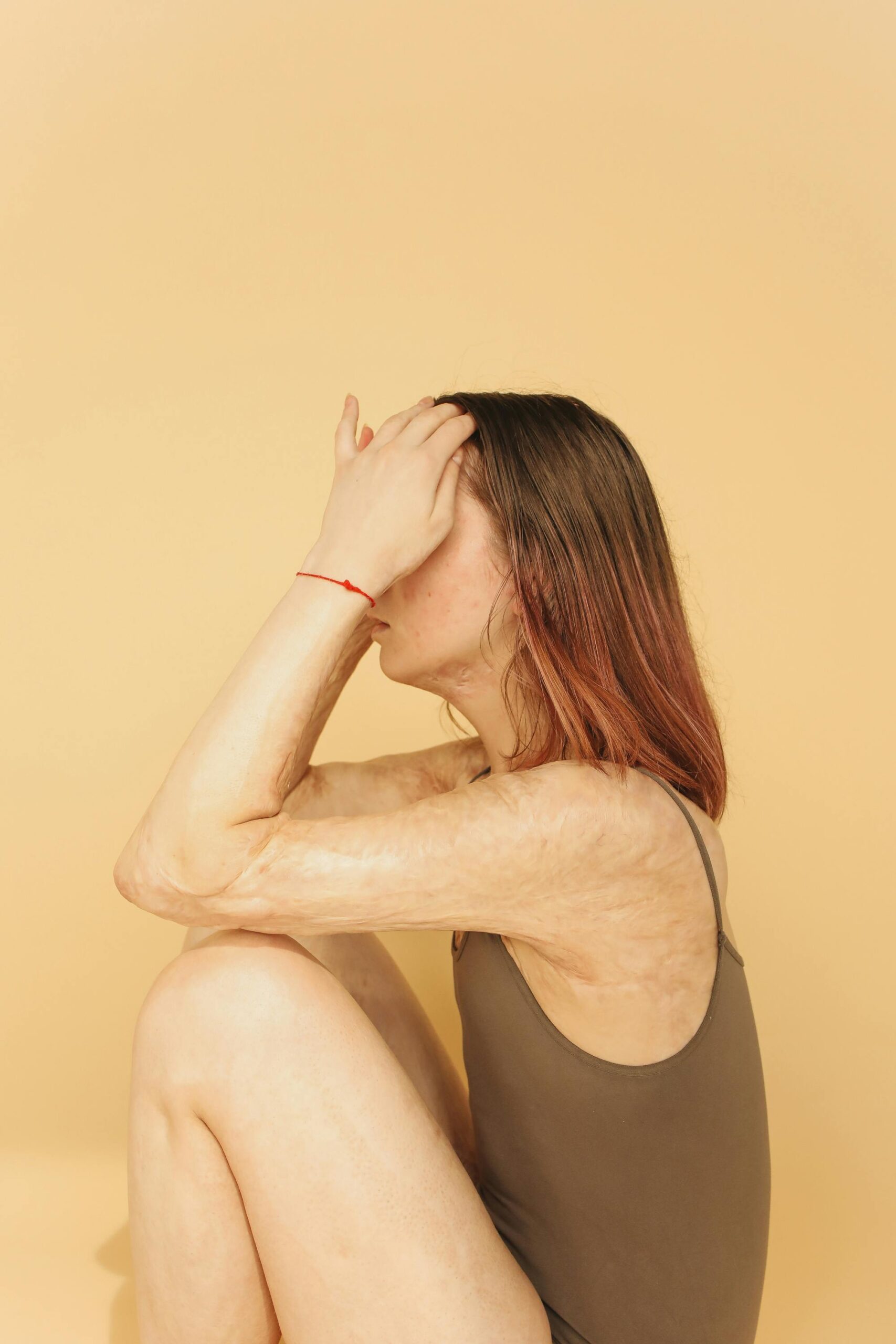 Side view of woman with burn scars sitting in a beige studio setting, conveying emotional resilience.